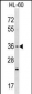 TAS2R7 Antibody (C-term)