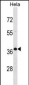 PABPN1 Antibody (C-term)
