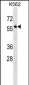 SEPT8 Antibody (C-term)