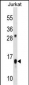 ATP5D Antibody (C-term)