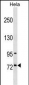 SF4 Antibody (Center)
