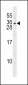 IL28B Antibody (N-term)