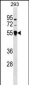 TRIM26 Antibody (N-term)