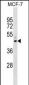 NR2F6 Antibody (N-term)