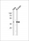 ATF2 Antibody (Center T339)