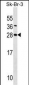 SDC4 Antibody (Center)