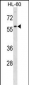 DCDC2 Antibody (Center)