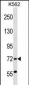 ABCF2 Antibody (N-term)