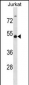 WTAP Antibody (C-term)