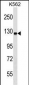 UBA6 Antibody (C-term)