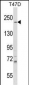 IQGAP1 Antibody (N-term)