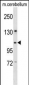 KIF5B Antibody (C-term)