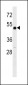 RARB Antibody (N-term)