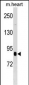 CUL2 Antibody (N-term)