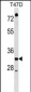 TSFM Antibody (C-term)