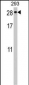 PTTG2 Antibody (Center)