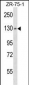 HKDC1 Antibody (C-term)