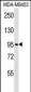 FBXO11 Antibody (N-term)