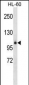 GPLD1 Antibody (Center)