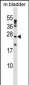 PTP4A1 Antibody (C-term)
