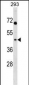 MRPL39 Antibody (C-term)