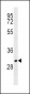 MS4A1 Antibody (C-term)