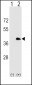 MS4A1 Antibody (C-term)