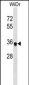 PPP1CC Antibody (C-term)