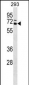 CARM1 Antibody (Center)