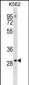 POLR3G Antibody (C-term)