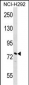 NOLC1 Antibody (N-term)