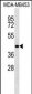 RBM4 Antibody (C-term)