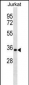 HNRNPA1 Antibody (C-term)
