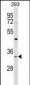 STX2 Antibody (N-term)