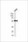 DDX6 Antibody (C-term)