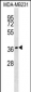 HEYL Antibody (N-term)