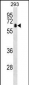 ZBTB7B Antibody (Center)