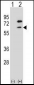 ZBTB7B Antibody (Center)