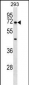 NR5A2 Antibody (Center)