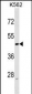 ACTL6A Antibody (N-term)