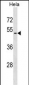 VIPR2 Antibody (N-term)