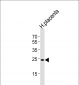 ANP32B Antibody (N-term)