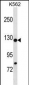 HIRA Antibody (N-term)