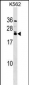 HAND2 Antibody (Center)