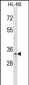 TP53RK Antibody (C-term)