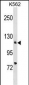 ATP2A2 Antibody (Center)