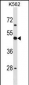 CD1D Antibody (Center)