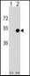 CD1D Antibody (Center)