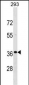 TNNT3 Antibody (C-term)