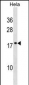 SCAND1 Antibody (C-term)